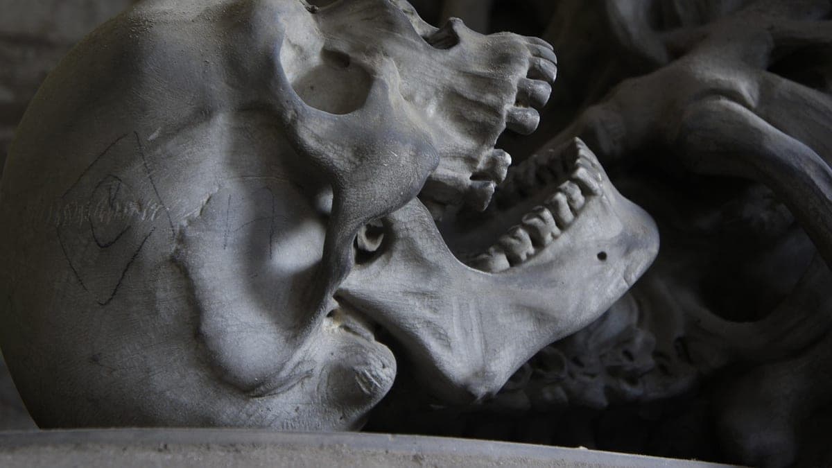 From Dentures to Fixed Teeth: Your All-on-X Options Explained