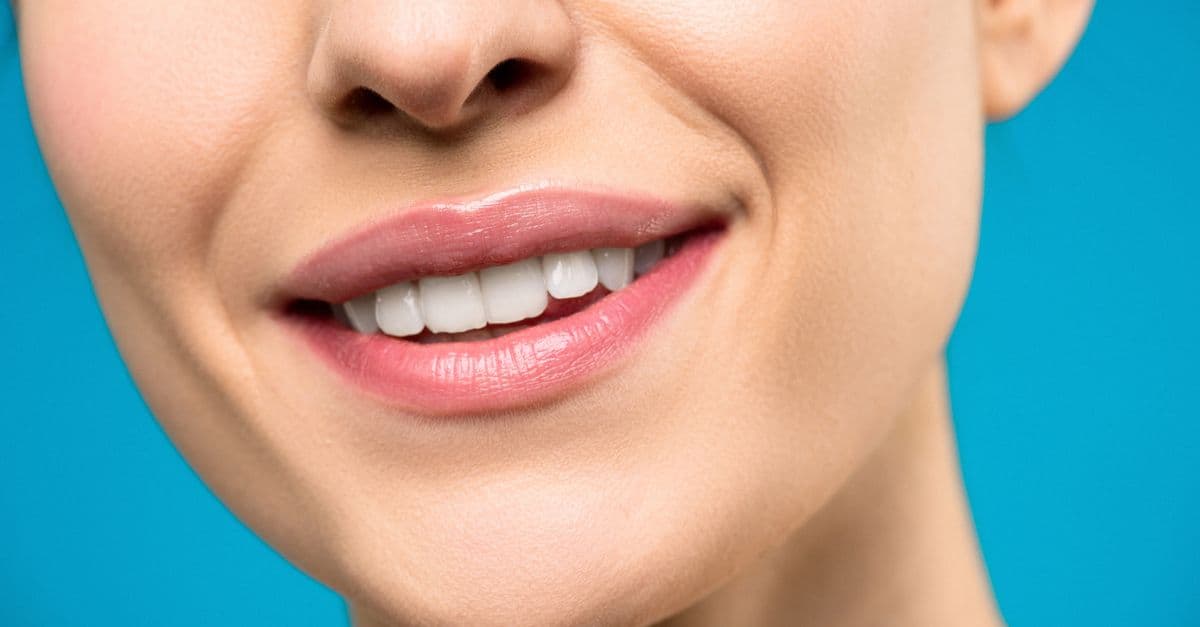 Hollywood-Smile in der Türkei: Kosten, Ablauf & Erwartungen