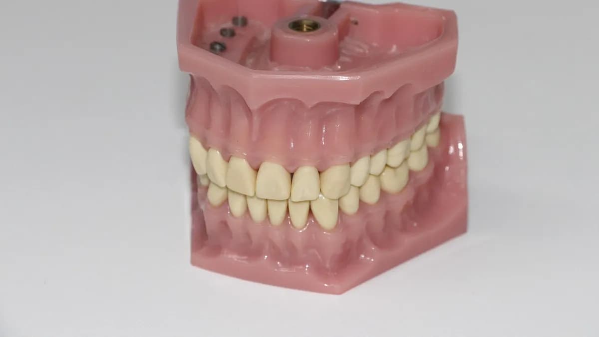 Fila de carillas que cubren los dientes visibles al sonreír
