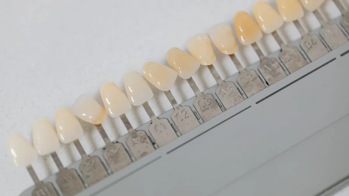 Laboratorio dental fabricando carillas de porcelana a medida