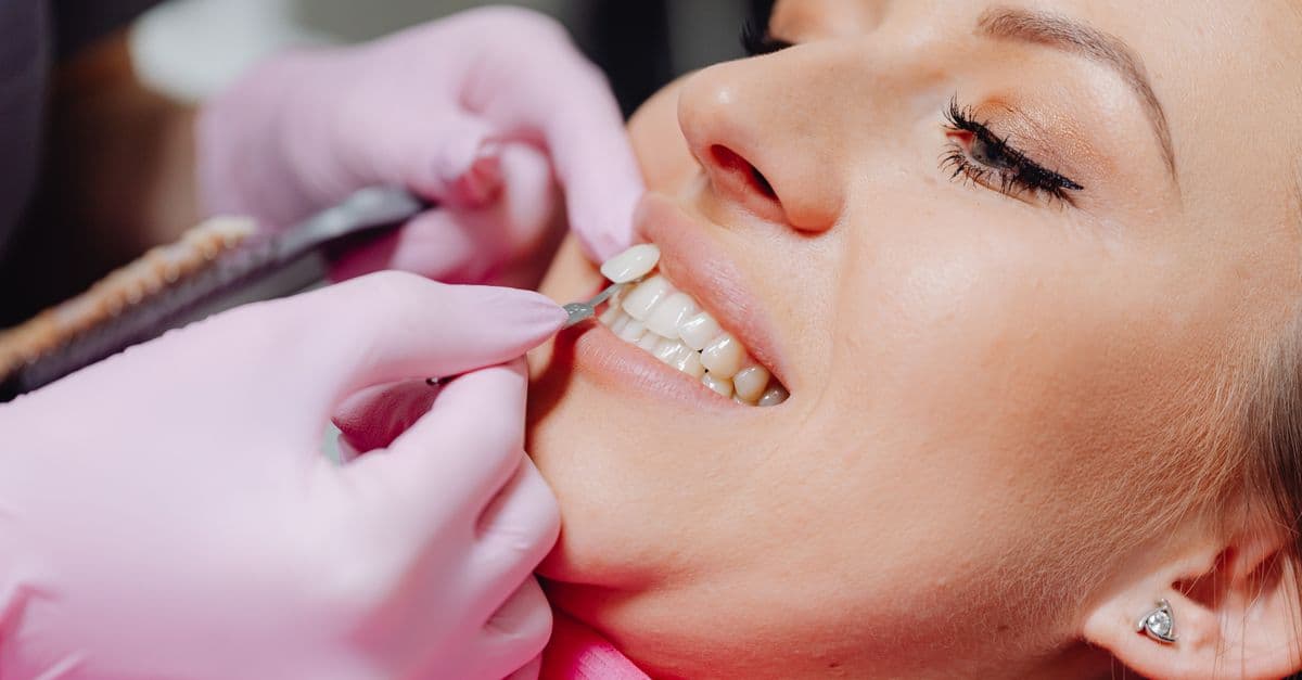 Porselen Lamine (Veneer) — Clinic Mery, Istanbul