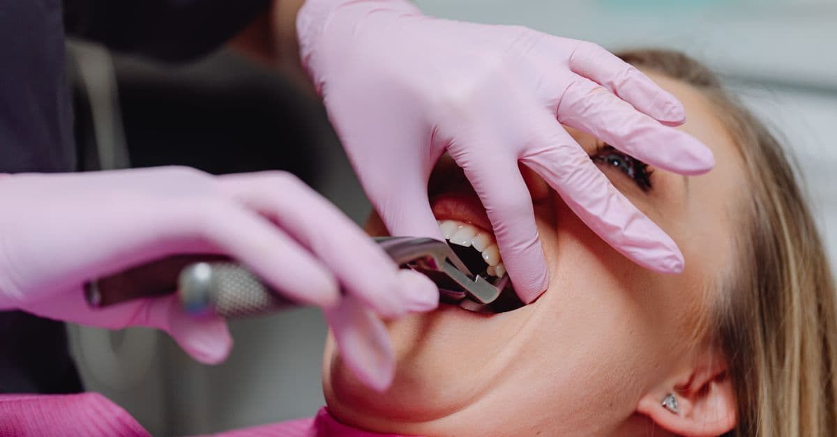 20'lik Diş Çekimi — Clinic Mery, Istanbul