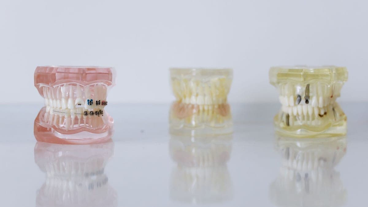 All-on-4 in Turkey: Fixed Teeth in a Day — Full Cost & Process Guide