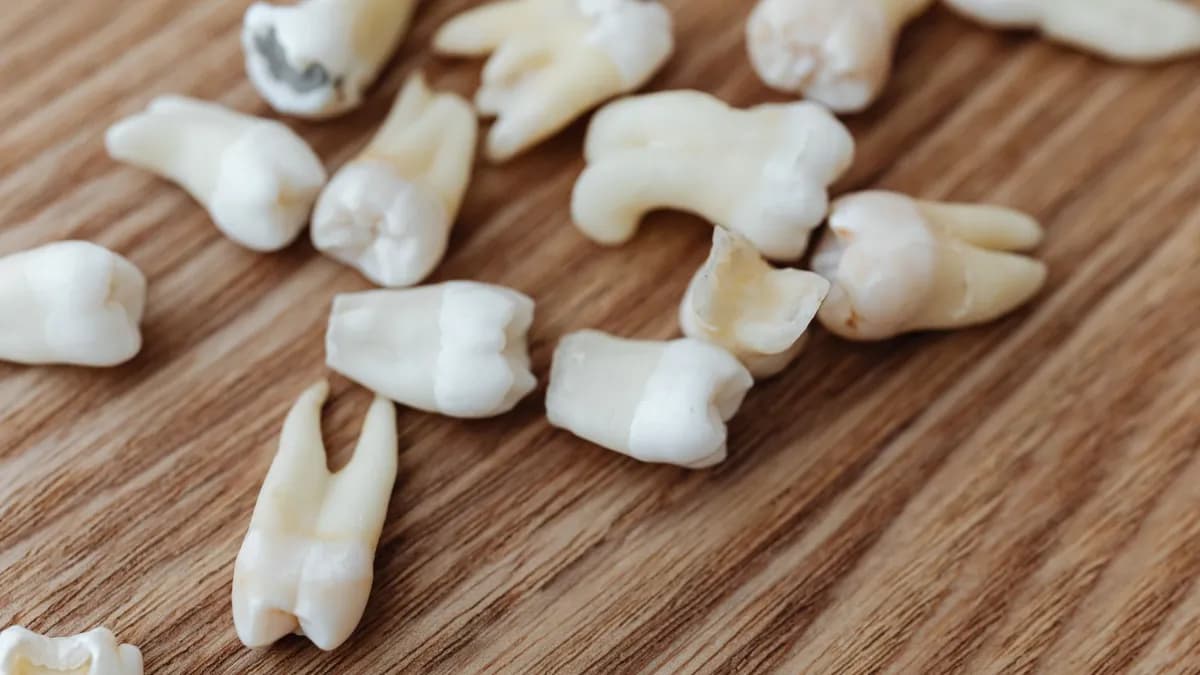 Modelo dental que muestra el poco esmalte que necesita una carilla