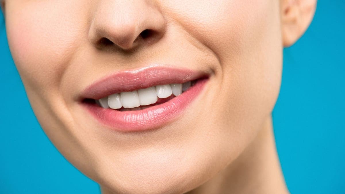 Hollywood Smile in Istanbul: What It Really Costs in 2026