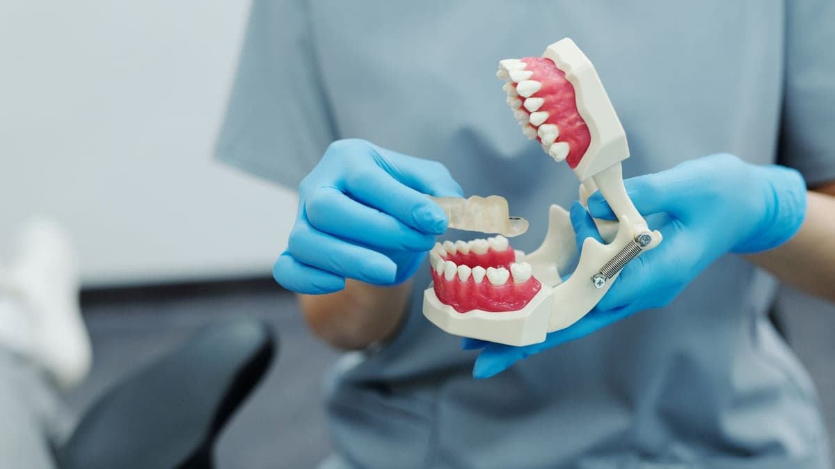 Implante Unitario vs. Puente vs. Dentadura: ¿Cuál Es Mejor?
