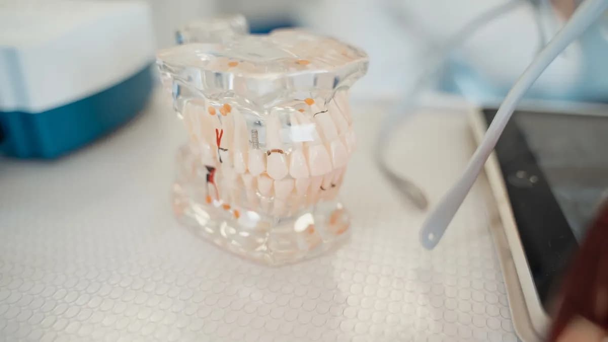 Zahnmodell vergleicht Veneer mit Vollkrone
