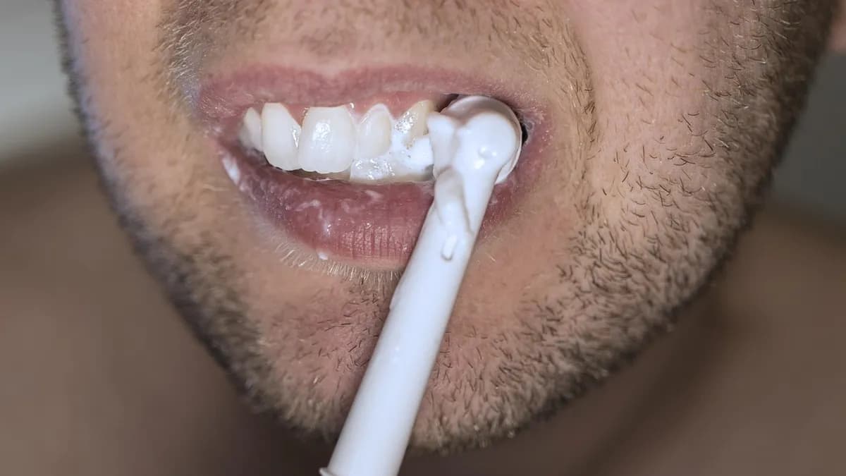 Comparación de antes y después de un blanqueamiento dental profesional